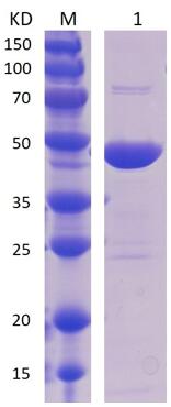 12% SDS-PAGE analysis profiles of purified NTHI0830-20-405 (CBB stained).